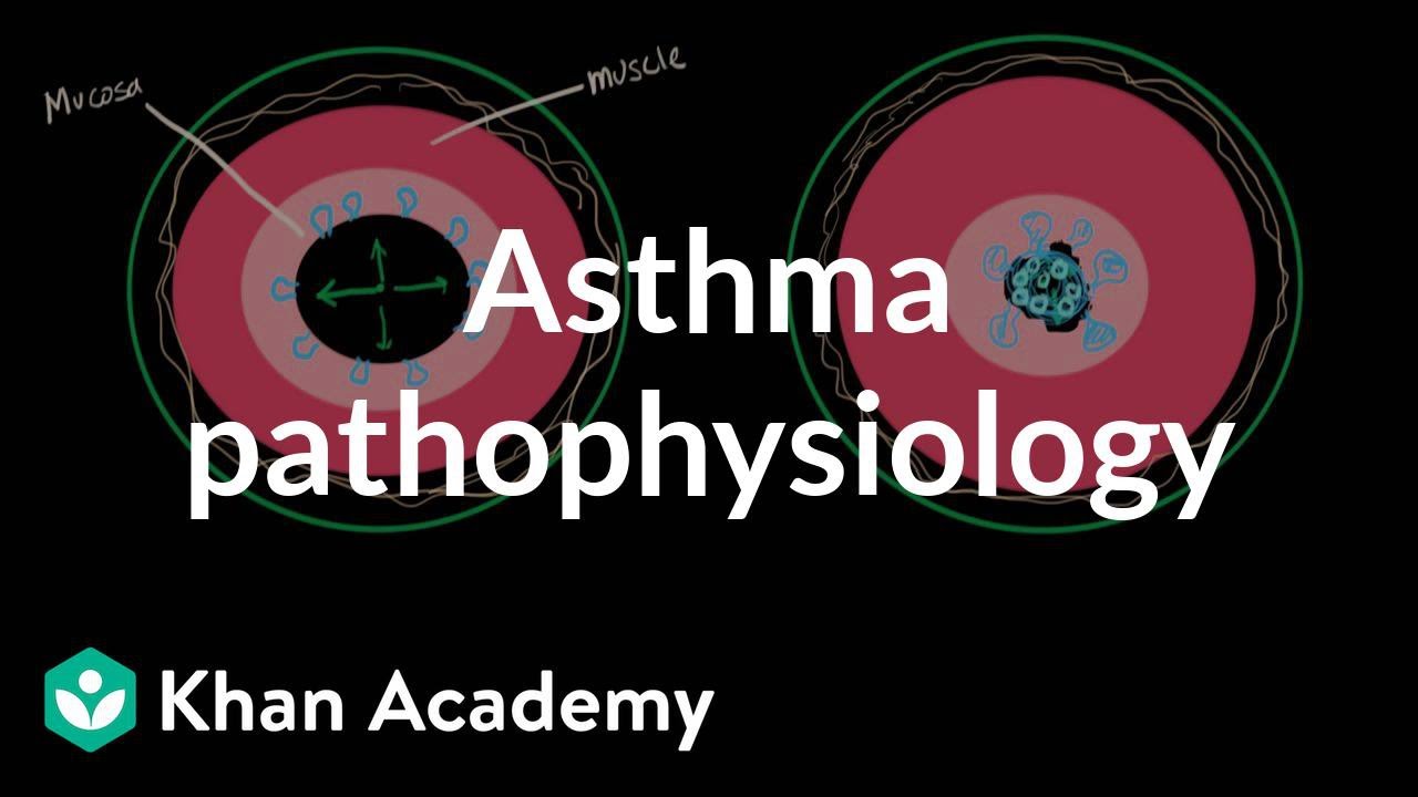 Asthma Pathophysiology Flow Chart