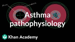 Asthma pathophysiology | Respiratory system diseases | NCLEXRN | Khan Academy