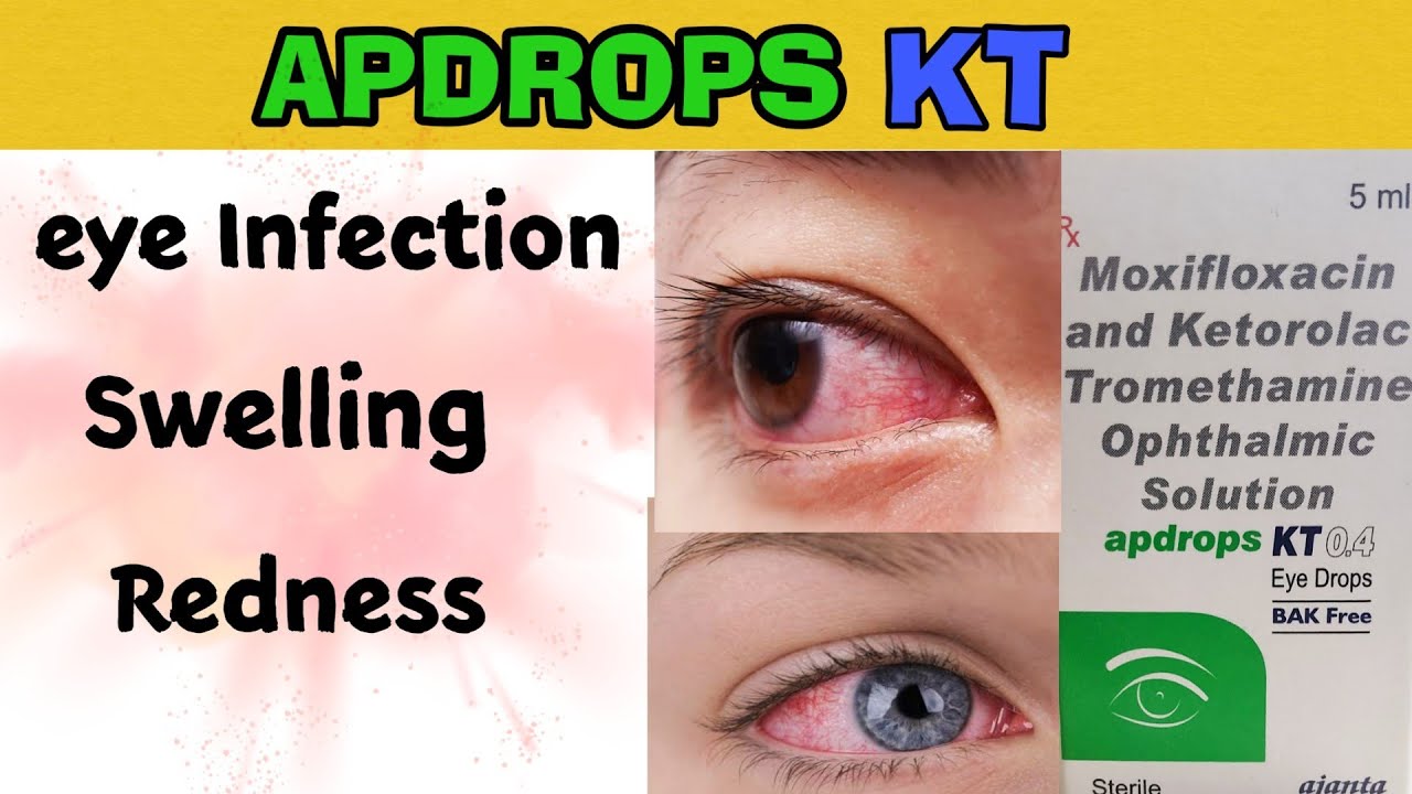 apdrops kt 0.4 eye drops uses moxifloxacin ketorolac tromethamine eye