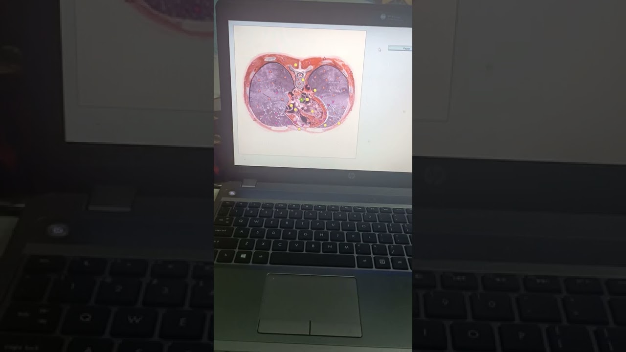 RAWATAN OZONE OLEH BIO-PLASMA TEKNOLOGI RUSIA