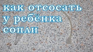 видео Грудничок хлюпает носом, но соплей нет – что делать?