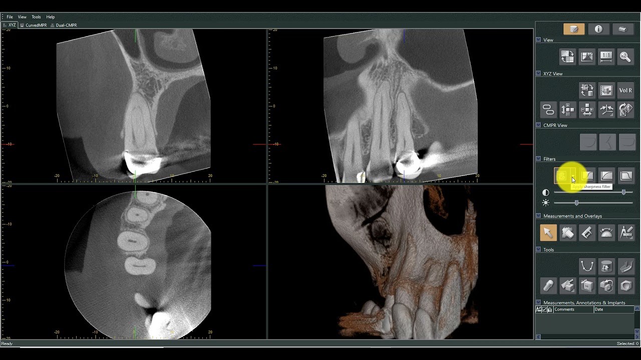 Dra. Rafaella Alencar - Tutorial Viewer Morita One Volume Viewer