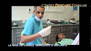 01 Mise En Charge Immédiate