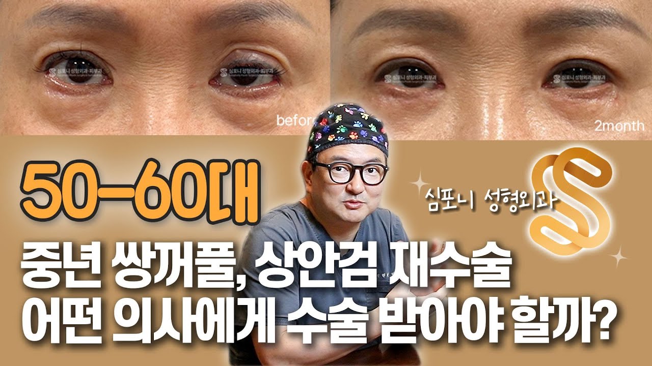 50-60대 중년 쌍꺼풀, 상안검 재수술 어떤 의사에게 수술 받아야 할까 1 - YouTube
