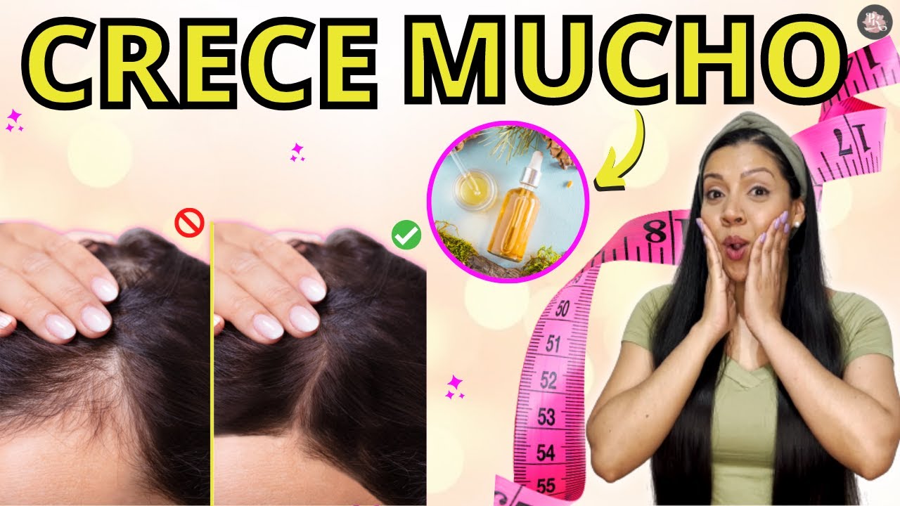 Aceite Para Hacer Crecer El Pelo Rapido Para La Caida Del Cabello  Tratamiento #1