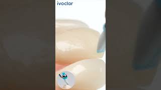 Ivoclar- Optrasculpt Pad Ortment