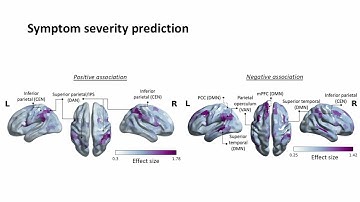 OHBM 2024 | Oral Session | Nga Yan Tse |  A mega-analysis of functional connectivity and network c…
