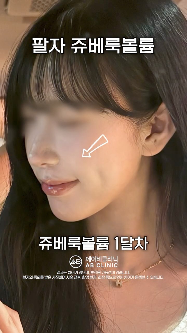 팔자주름이 신경 쓰인다면?