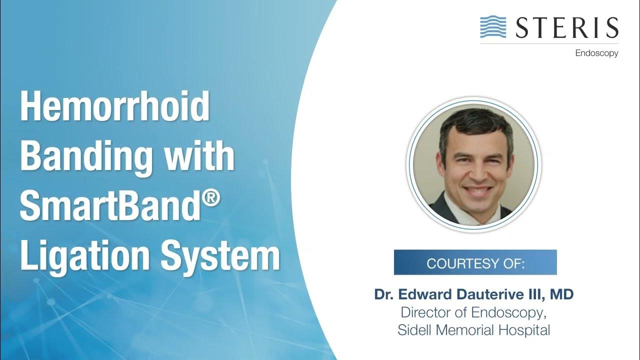 Hemorrhoid Banding Using the SMARTBAND™ MultiBand Ligation System