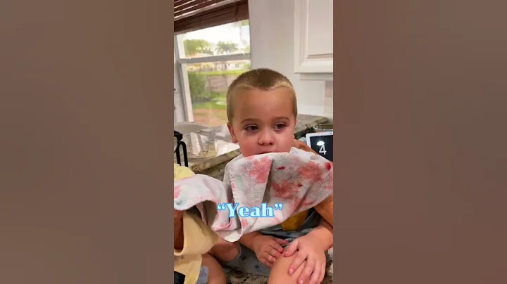 Ever heard of a sympathy bloody nose? Bryson had one today…