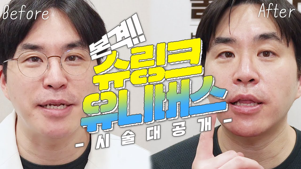 슈링크 유니버스 본격적으로 시술 해보자! (fear.송원장님)ㅣ슈링크 유니버스 부스터, 슈링크 유니버스 후기, 슈링크 유니버스 앰플ㅣ제이필TV