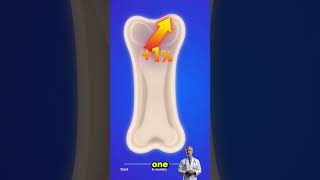 How to Strengthen Bones After 60 — Stop Osteoporosis with These 5 Exercises #seniorhealthsecrets