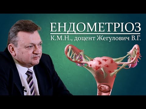 Відеолекція ЕНДОМЕТРІОЗ. Жегулович В.Г.