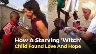 The Rescue Of A Starving 'Witch' Child Is Hope For Humanity