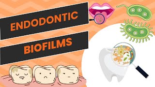 What are Endodontic Biofilms ? I SAQ #endodontics #periodontology @A2ZDentistry
