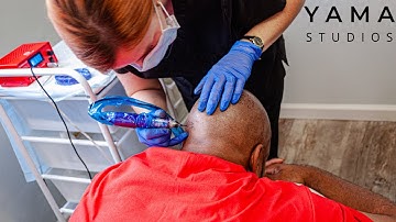 Does Scalp Micropigmentation Look Natural? A Hawaii SMP Practitioner Explains