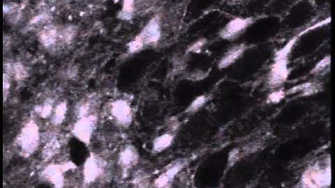 Stimulus-induced astrocytic Ca waves in hippocampal slice