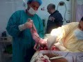 توام ولد و بنت xx xy الدكتور علاء رفاعى