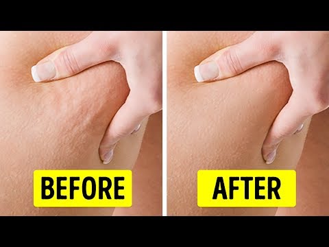 Video: Butt Cellulit: 6 Latihan Untuk Menghilangkan Dimpling Dan Mengencangkan Gl