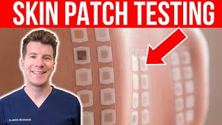 ALLERGY TESTING: Doctor explains the Skin Patch Test