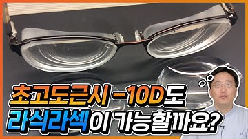 -10D 초고도근시도 라식라섹이 가능할까요?