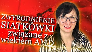 Zwyrodnienie siatkówki związane z wiekiem AMD.