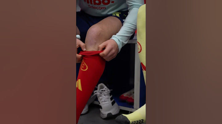 🔴🟡 ‘Calcetines desparejados’ por el #DíaMundialSíndromeDown | 🔴 SEFUTBOL
