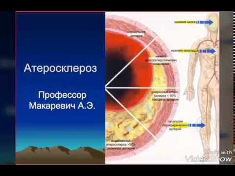 Видео: Аэробные упражнения и упражнения с отягощениями улучшают физическую форму, здоровье костей и качество жизни у лиц, переживших ожирение и ожирение: рандомизированное контролируемое