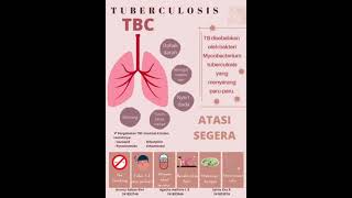 PROMKES-POSTER TBC (TUBERCULOSIS)-KELOMPOK 2 A-UNIVERSITAS SETIA BUDI SURAKARTA