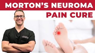 Morton Neuroma Foot Pain * HOME Treatment*