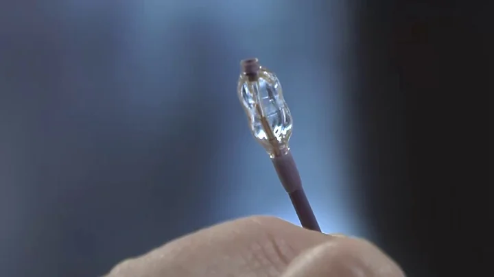 Peripheral Angioplasty