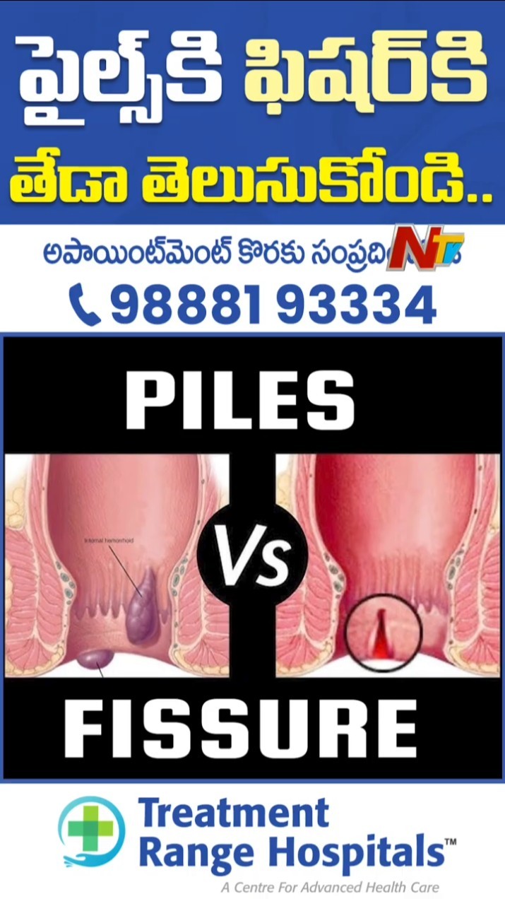 Piles Laser Surgery | Best Treatment for Piles | Treatment Range Hospitals, KPHB Hyderabad | NTV