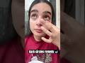 Best remedy 😊… #viralshort #short #shorts #viralshorts #ytshorts #skincare #homeremedies