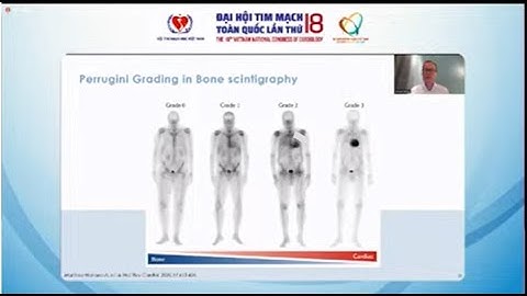Đại Hội Tim mạch toàn quốc lấn thứ 18