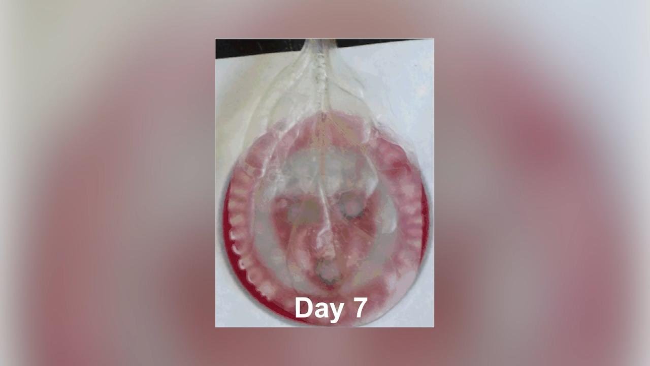 Heart Stem Cells Grown in Spinach?