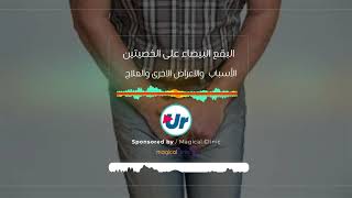 البقع البيضاء على الخصيتين، الأسباب  والاعراض الاخرى والعلاج