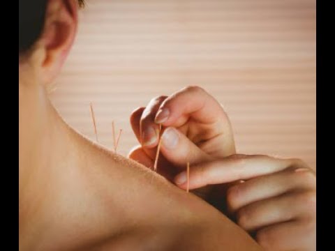 Acupuncture Natural Health Centre Buncrana Co Donegal by Kim McMenamin