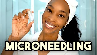 Microneedling: What you need to know, from a dermatologist and Skin of color Expert