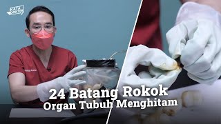 Eksperimen: Cukup 24 Batang Rokok Mampu Merusak Organ Tubuh Kita | Kata Dokter