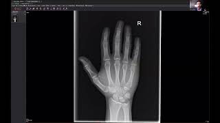 Punching the Wall | Emergency X-Ray Course