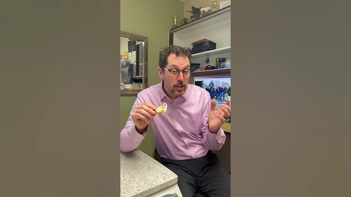 Congrats on starting your lower lingual holding arch (space maintainer) journey!