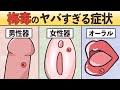 【性病】梅毒に感染するとどうなってしまうのか?