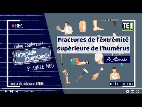 Vidéo: Humérus - Fracture Du Tubercule, Fracture Du Cou