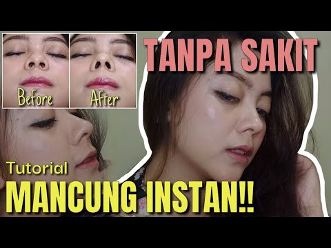 MEMANCUNGKAN HIDUNG INSTAN CEPAT TANPA SAKIT. BENERAN BAGUS BANGET! || #ReviewPart1 || CEFRYNA CHAN