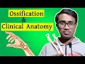 Radius Anatomy Bangla || Ossification & Clinical Anatomy || পিকেএস লেকচার