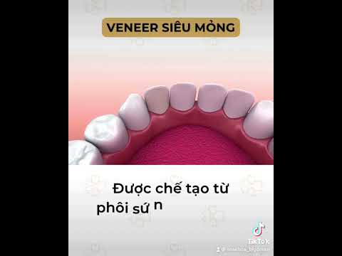 Thế nào là