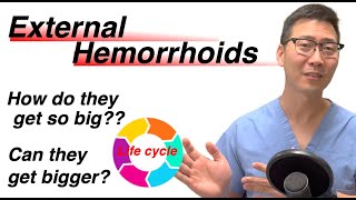 Life cycle of External Hemorrhoids! From baby to adult. | Dr. Chung explains! screenshot 5