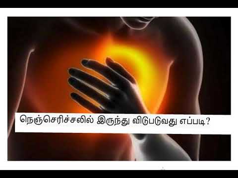 நெஞ்செரிச்சலில் இருந்து விடுபடுவது எப்படி?#chestburn#heartburn#cold#healthylifestyle#covid#Tamil