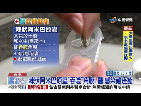 手沒擦乾戴隱形眼鏡! 正妹"角膜遭吞噬"全盲│中視新聞 20200930