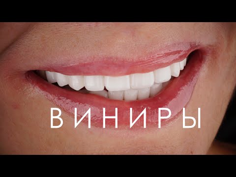 Керамические виниры. Имплантация зубов. Коронки из диоксида циркония и имакс (Emax)
